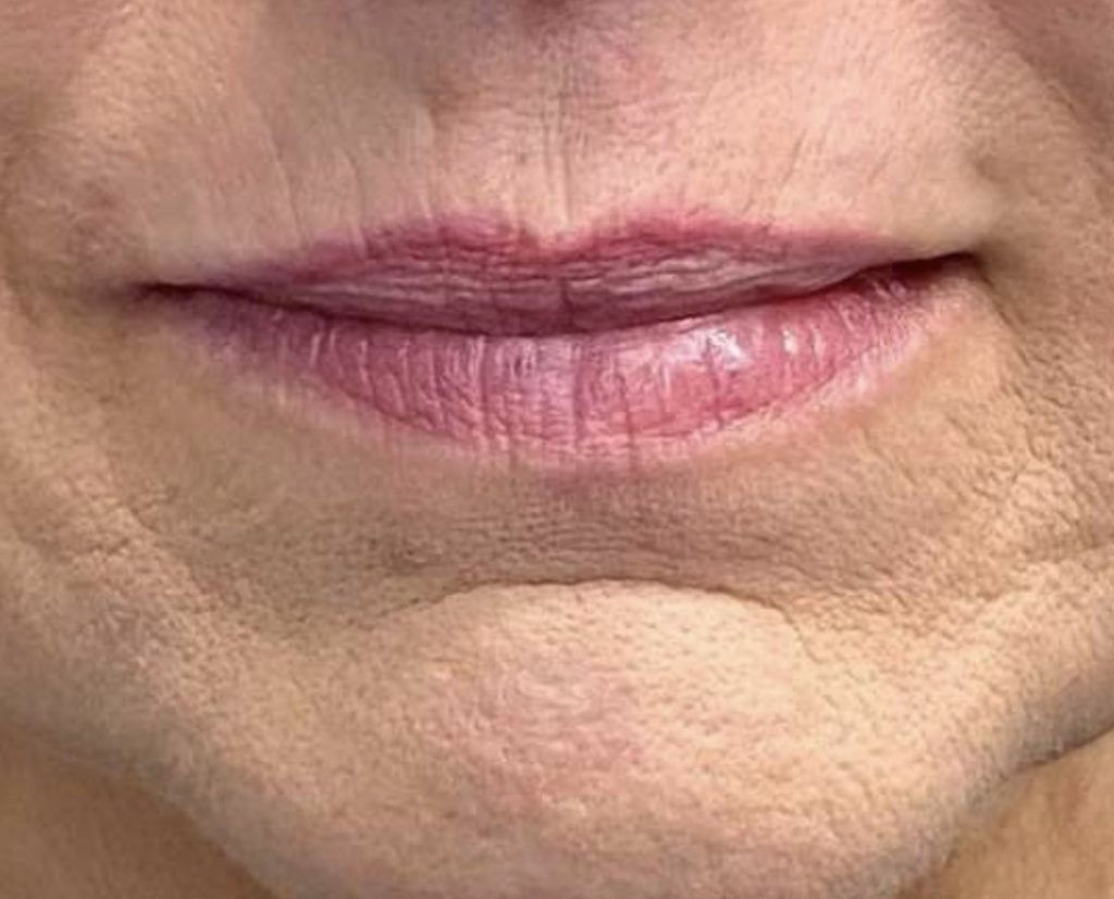 Close-up of mature lips showing signs of aging and skin texture.